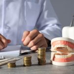 Dental Implant Cost For Full Mouth: How Much Are Full Mouth Dental Implants